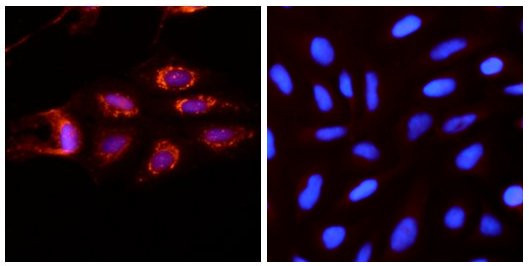 ATG9A Antibody in Immunocytochemistry (ICC/IF)