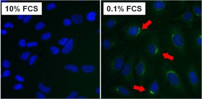 ATG9A Antibody in Immunocytochemistry (ICC/IF)