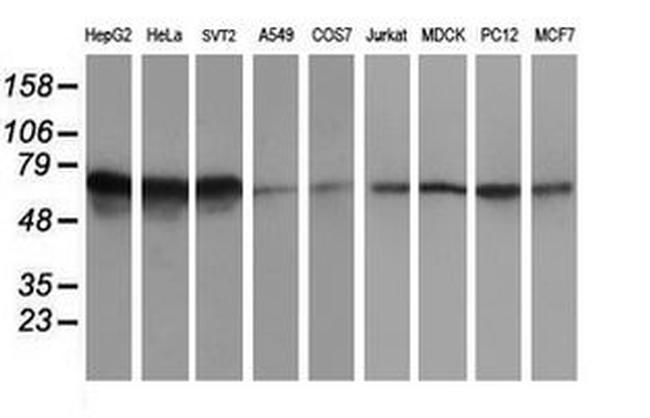 ATIC Antibody in Western Blot (WB)