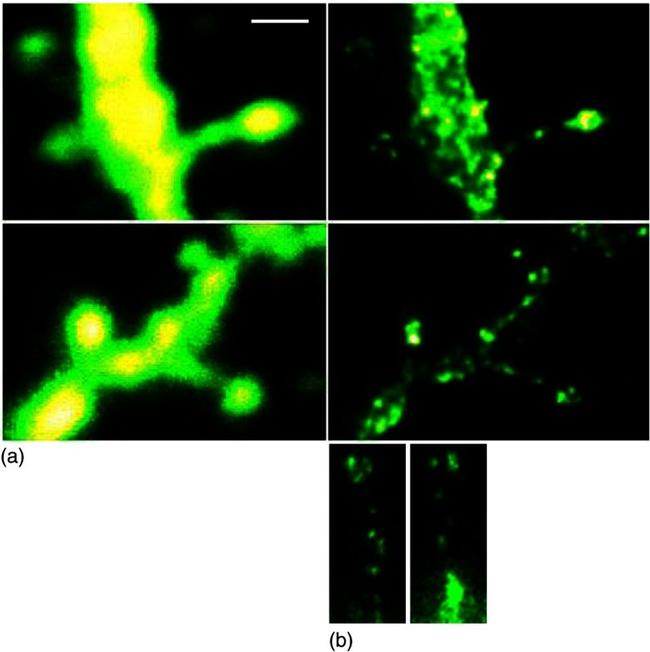 ATP1A3 Antibody in Immunocytochemistry (ICC/IF)