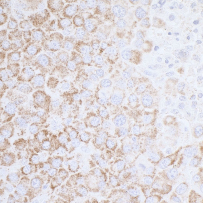 ATP5A1 Antibody in Immunohistochemistry (IHC)