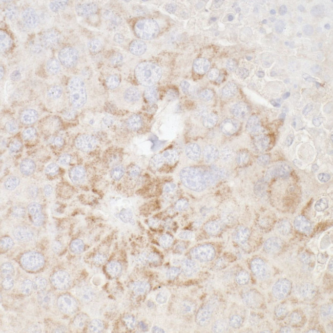 ATP5A1 Antibody in Immunohistochemistry (IHC)