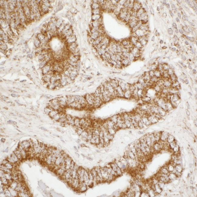 ATP5A1 Antibody in Immunohistochemistry (IHC)