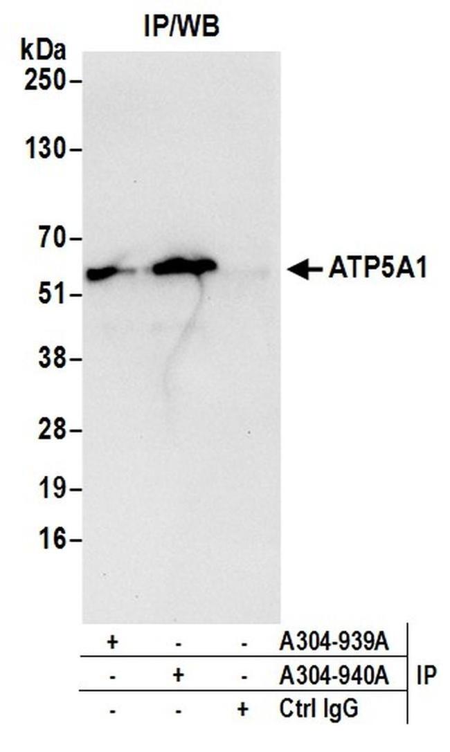 ATP5A1 Antibody in Western Blot (WB)