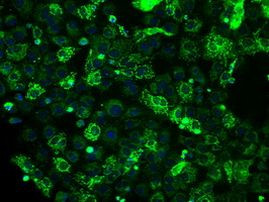 ATP5B Antibody in Immunocytochemistry (ICC/IF)