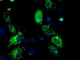 ATP5B Antibody in Immunocytochemistry (ICC/IF)