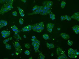 ATP5B Antibody in Immunocytochemistry (ICC/IF)