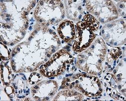 ATP5B Antibody in Immunohistochemistry (Paraffin) (IHC (P))