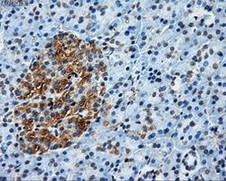 ATP5B Antibody in Immunohistochemistry (Paraffin) (IHC (P))