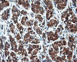 ATP5B Antibody in Immunohistochemistry (Paraffin) (IHC (P))