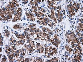 ATP5B Antibody in Immunohistochemistry (Paraffin) (IHC (P))