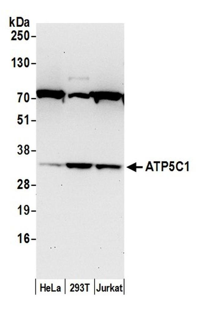 ATP5C1/ATPG Antibody in Western Blot (WB)