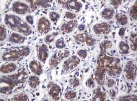 ATP5C1 Antibody in Immunohistochemistry (Paraffin) (IHC (P))