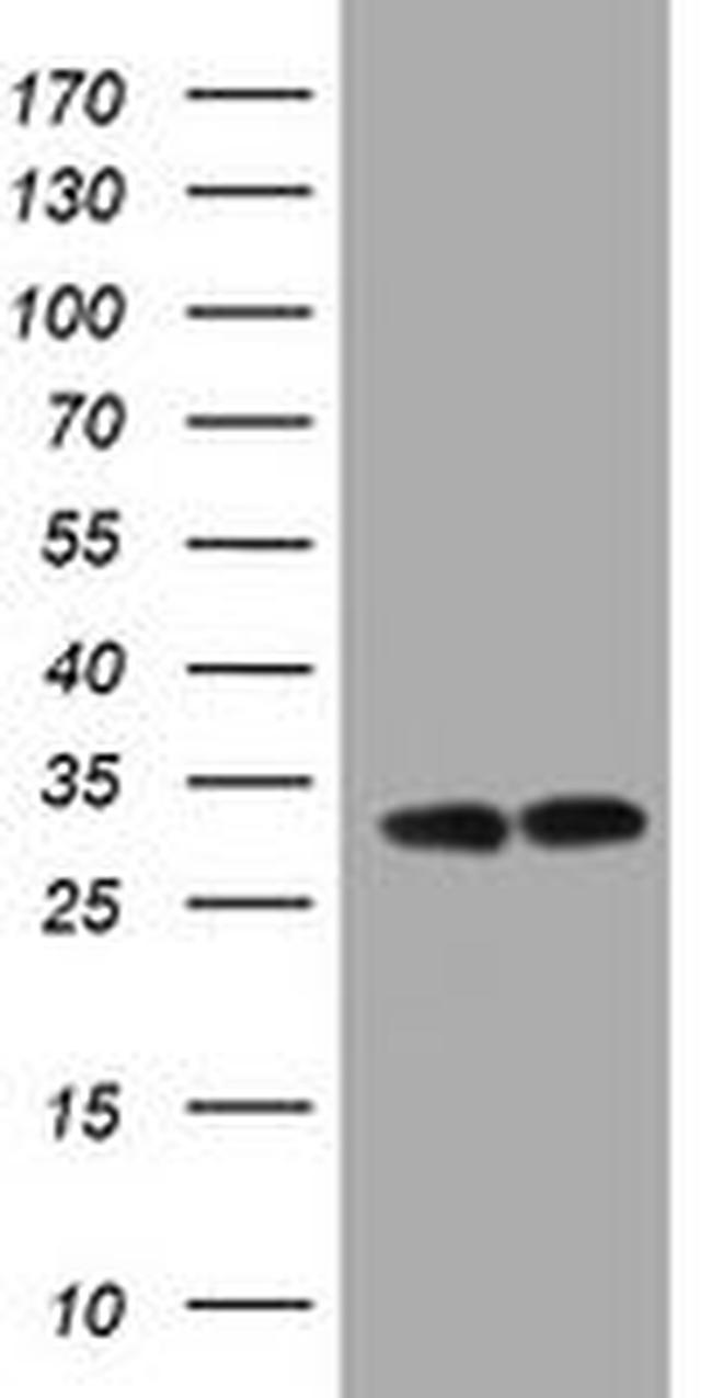 ATP5C1 Antibody in Western Blot (WB)