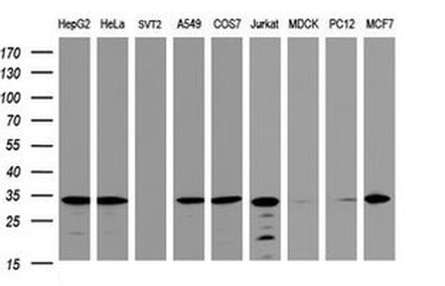 ATP5C1 Antibody in Western Blot (WB)