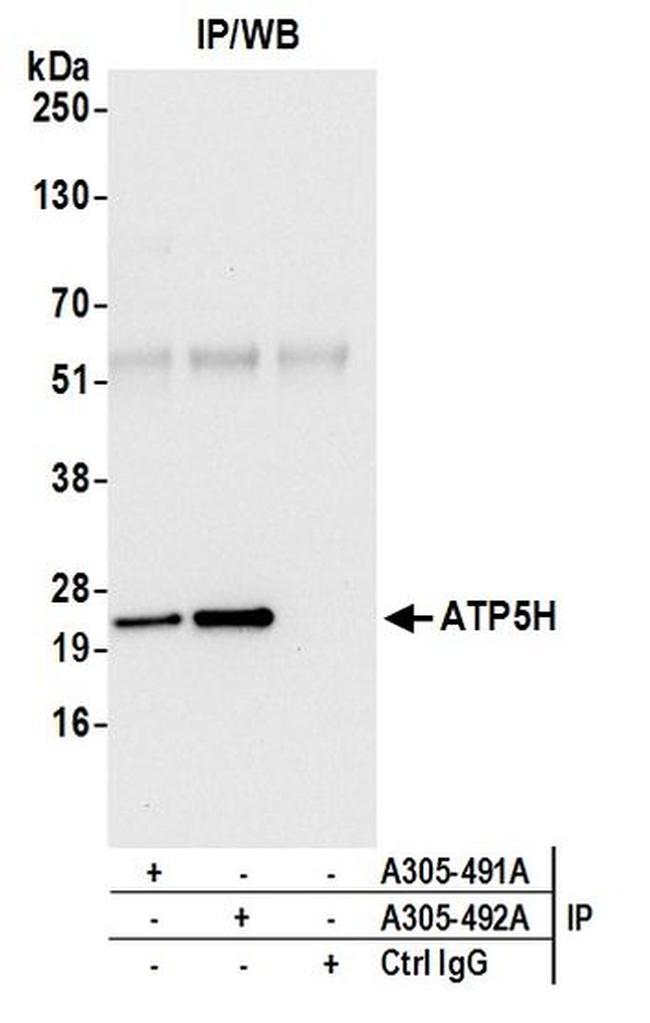 ATP5H Antibody in Western Blot (WB)