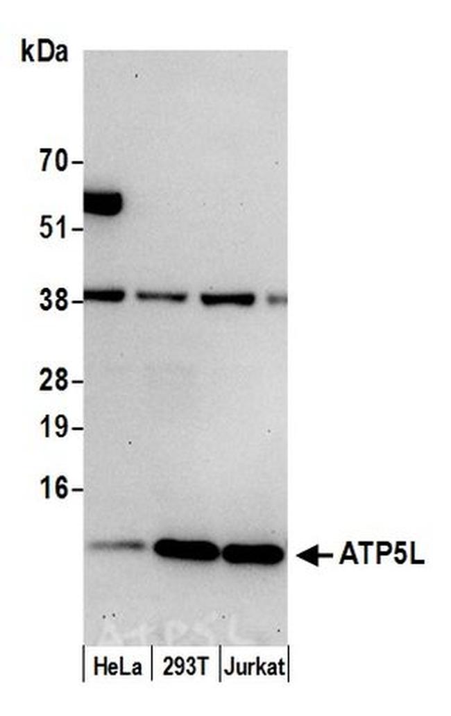 ATP5L Antibody in Western Blot (WB)