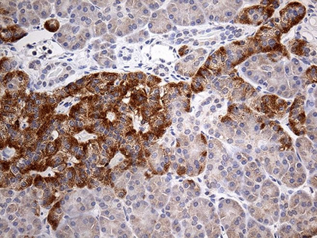 ATP6V0D2 Antibody in Immunohistochemistry (Paraffin) (IHC (P))