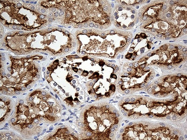 ATP6V0D2 Antibody in Immunohistochemistry (Paraffin) (IHC (P))