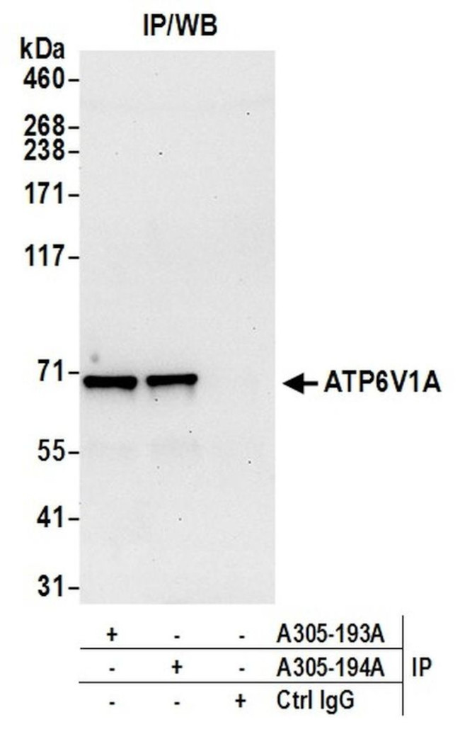 ATP6V1A Antibody in Immunoprecipitation (IP)