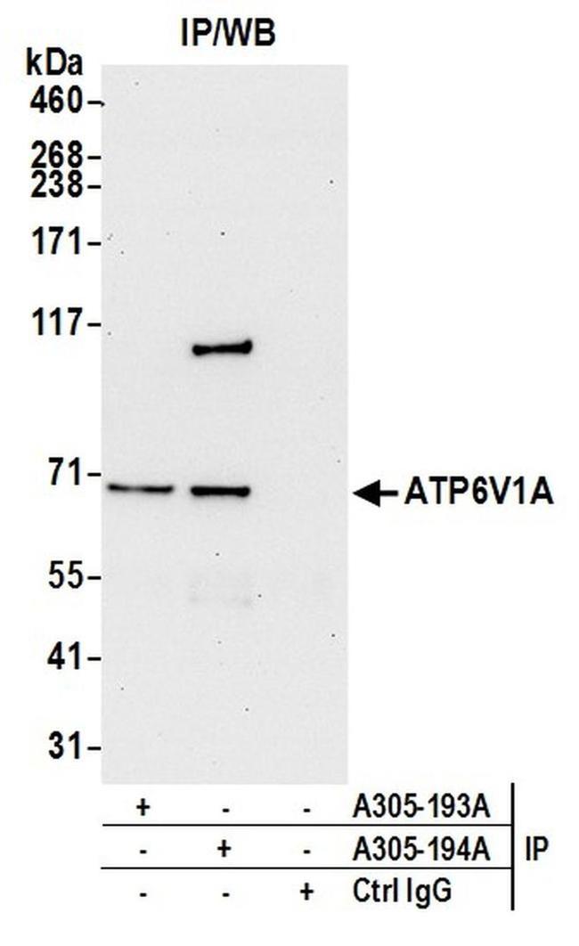 ATP6V1A Antibody in Western Blot (WB)