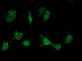 ATP6V1B1 Antibody in Immunocytochemistry (ICC/IF)