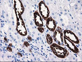 ATP6V1B1 Antibody in Immunohistochemistry (Paraffin) (IHC (P))