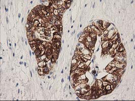 ATP6V1B1 Antibody in Immunohistochemistry (Paraffin) (IHC (P))