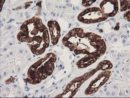 ATP6V1B1 Antibody in Immunohistochemistry (Paraffin) (IHC (P))