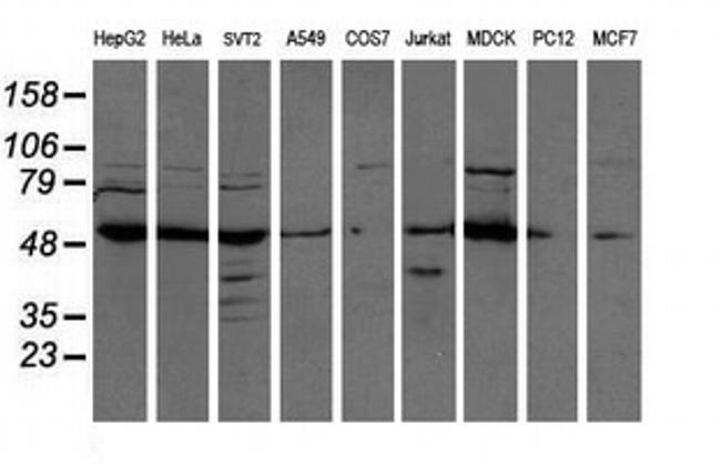 ATP6V1B1 Antibody in Western Blot (WB)