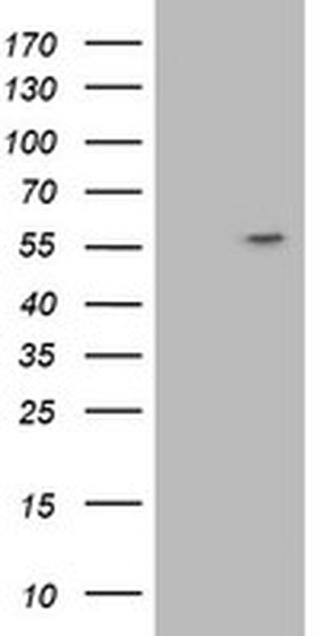 ATP6V1B1 Antibody in Western Blot (WB)