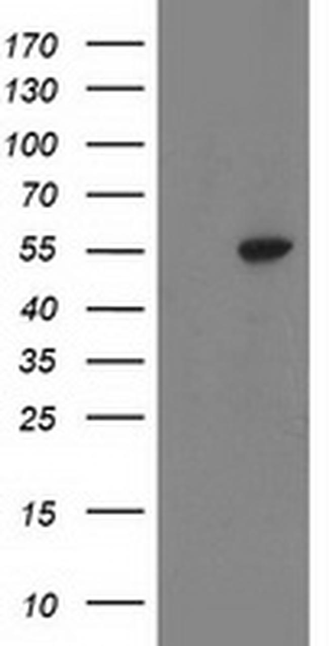 ATP6V1B1 Antibody in Western Blot (WB)