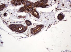 ATP6V1B2 Antibody in Immunohistochemistry (Paraffin) (IHC (P))