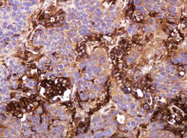 ATP6V1B2 Antibody in Immunohistochemistry (Paraffin) (IHC (P))