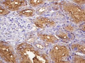 ATP6V1B2 Antibody in Immunohistochemistry (Paraffin) (IHC (P))