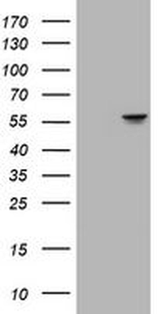 ATP6V1B2 Antibody in Western Blot (WB)