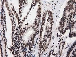 ATP6V1F Antibody in Immunohistochemistry (Paraffin) (IHC (P))