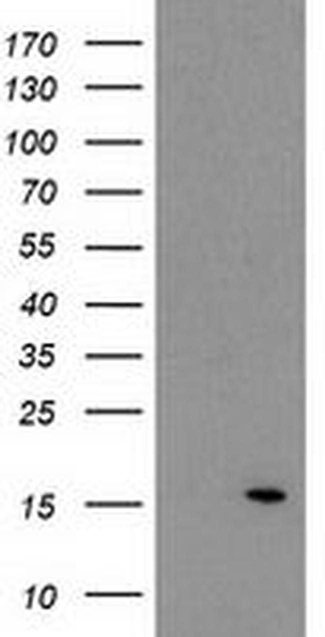 ATP6V1F Antibody in Western Blot (WB)