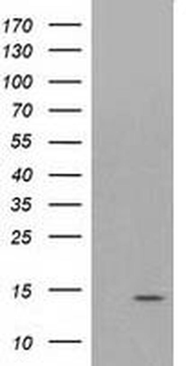 ATP6V1F Antibody in Western Blot (WB)