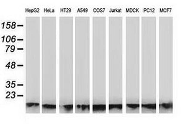 ATP6V1F Antibody in Western Blot (WB)