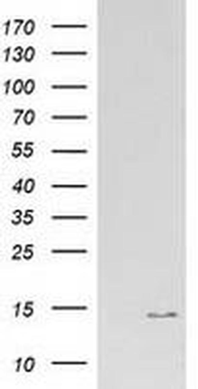 ATP6V1F Antibody in Western Blot (WB)