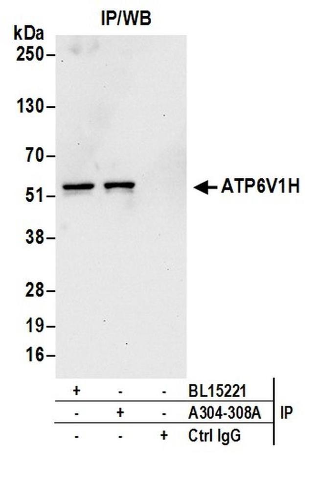 ATP6V1H Antibody in Western Blot (WB)