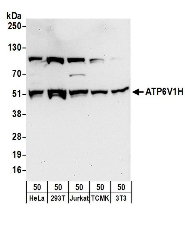 ATP6V1H Antibody in Western Blot (WB)