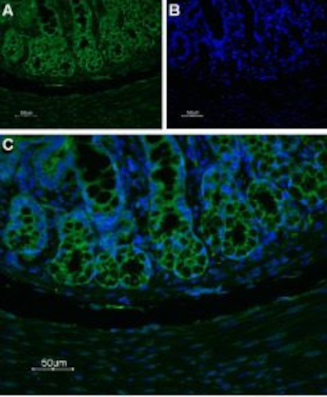 Neurokinin 1 Receptor (NK1R) (extracellular) Antibody in Immunohistochemistry (Paraffin) (IHC (P))