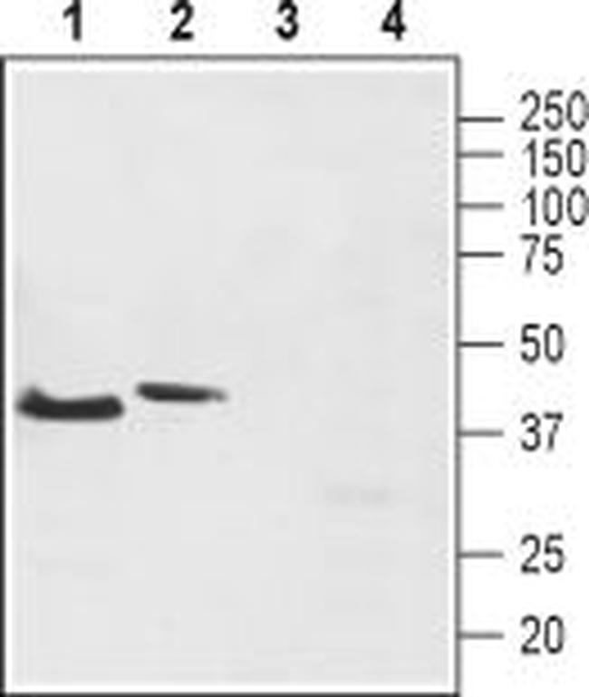 Neurokinin 2 Receptor (NK2R) Antibody in Western Blot (WB)