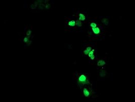 ATRIP Antibody in Immunocytochemistry (ICC/IF)