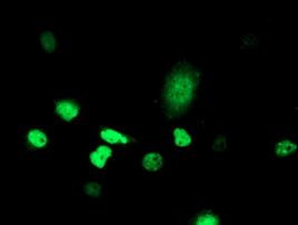 ATRIP Antibody in Immunocytochemistry (ICC/IF)