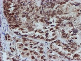 ATRIP Antibody in Immunohistochemistry (Paraffin) (IHC (P))