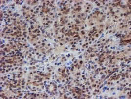 ATRIP Antibody in Immunohistochemistry (Paraffin) (IHC (P))