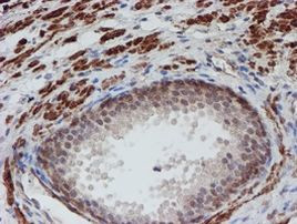 ATRIP Antibody in Immunohistochemistry (Paraffin) (IHC (P))